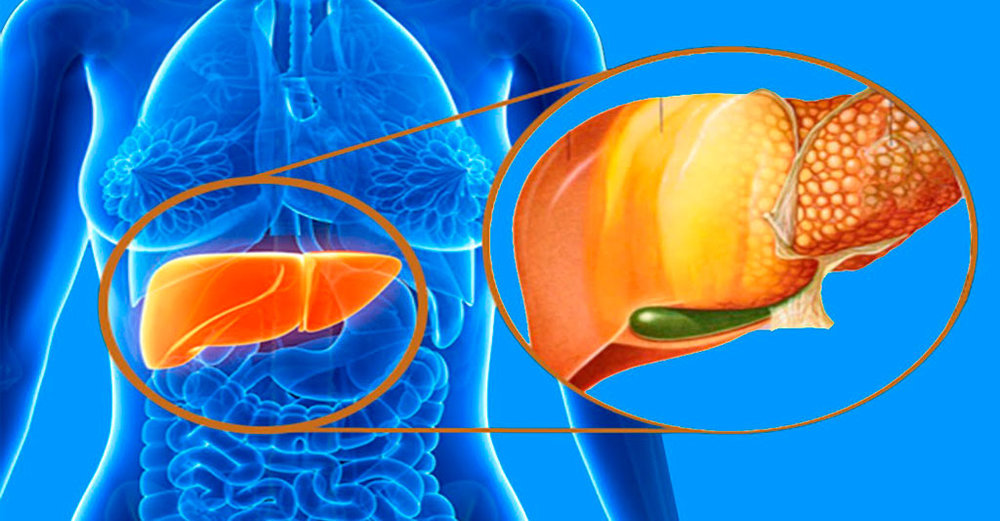 آشنایی با علائم کبد چرب + راه حل درمانی در طب سنتی