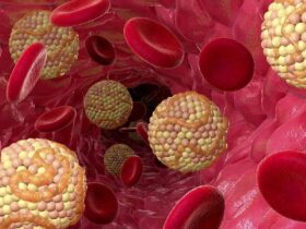درمان چربی خون در طب سنتی علل افزایش چربی