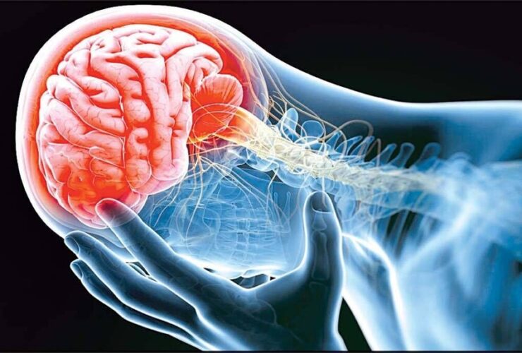 سالانه 150 هزار مورد سکته در کشور