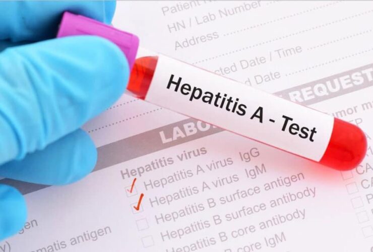 هپاتیت A چیست و چه علائمی دارد؟