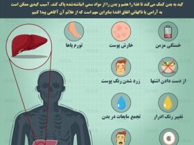 10 علامت و نشانه کبد چرب