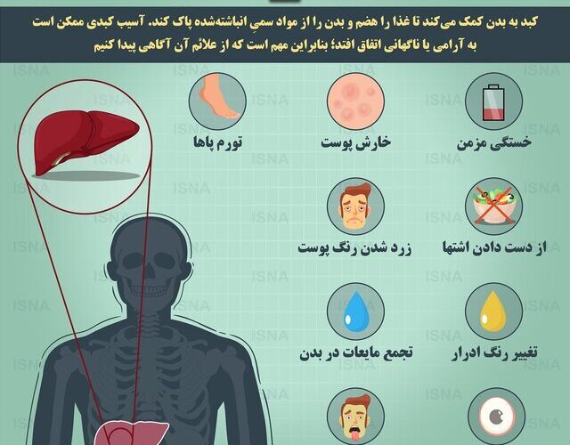 10 علامت و نشانه کبد چرب