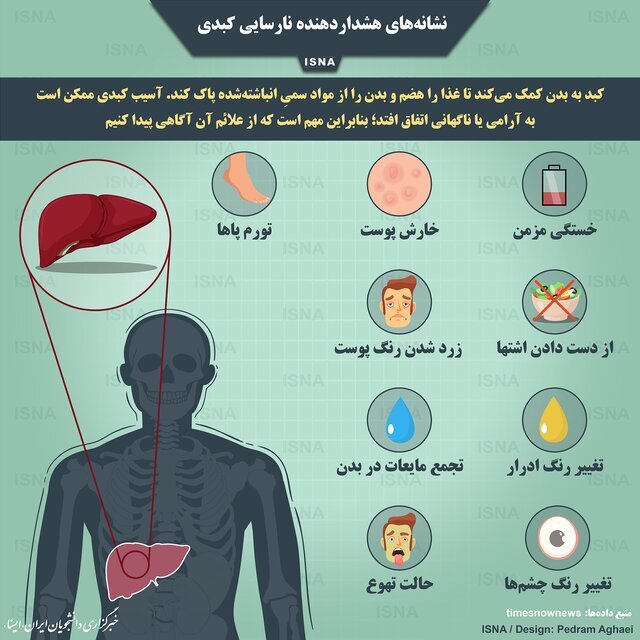 10 علامت و نشانه کبد چرب