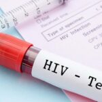 آزمایش رایگان و محرمانه HIV؛ جزئیات مراکز آزمایش HIV