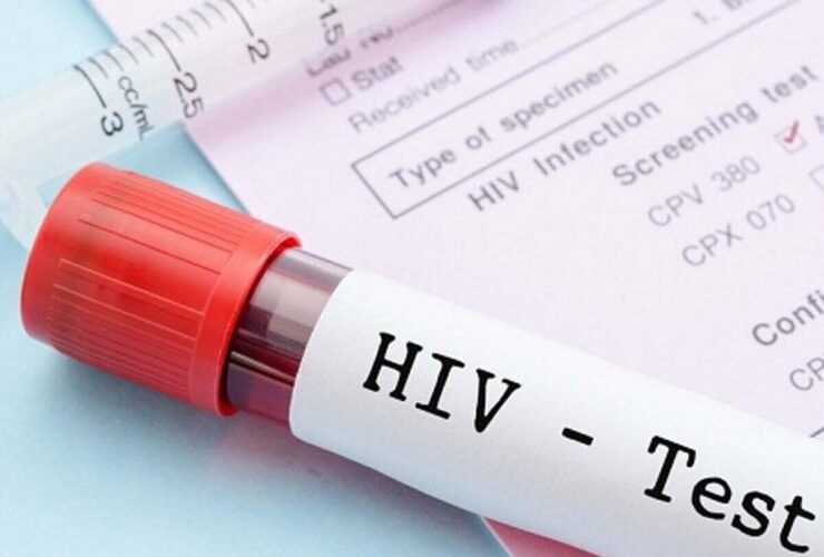 آزمایش رایگان و محرمانه HIV؛ جزئیات مراکز آزمایش HIV