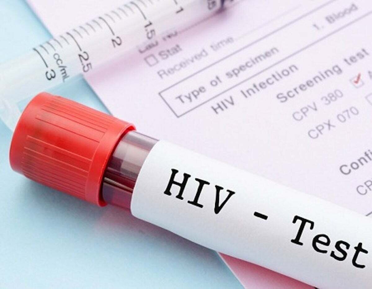 آزمایش رایگان و محرمانه HIV؛ جزئیات مراکز آزمایش HIV