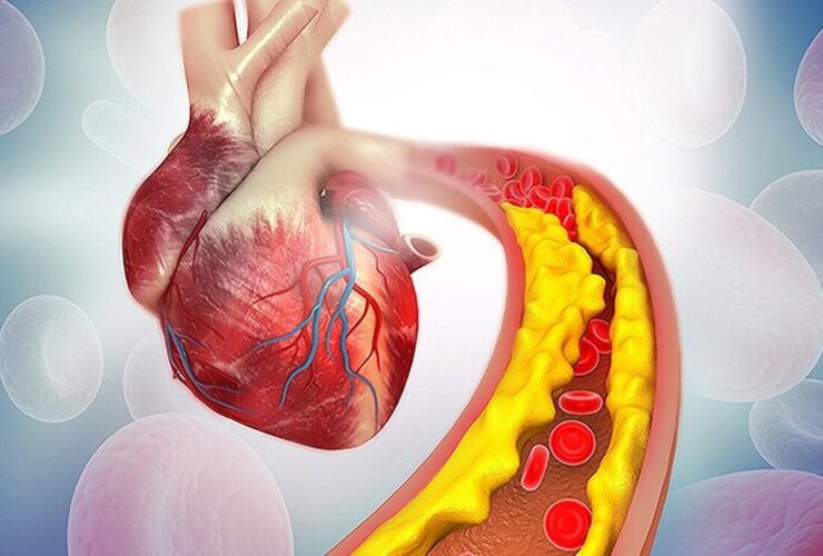 بدترین غذاهایی که کلسترول خون را افزایش می دهند کدامند؟