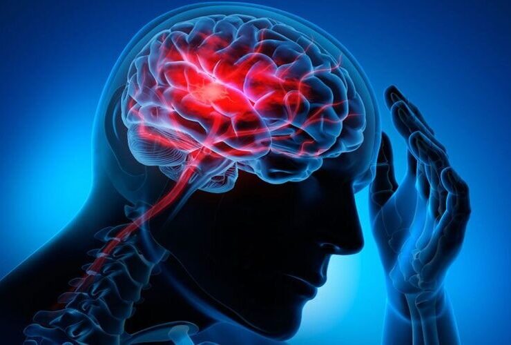 تاثیر رژیم غذایی و فعالیت بدنی در کاهش خطر سکته