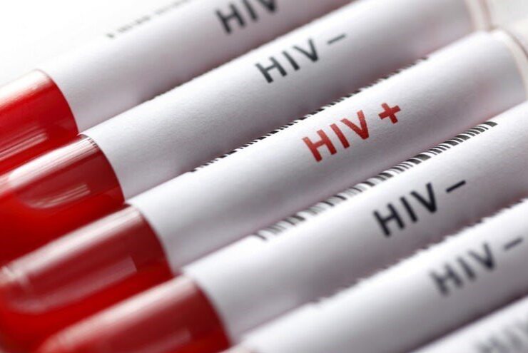 درمان موفق ایدز در کشور انتقال HIV از مادر به