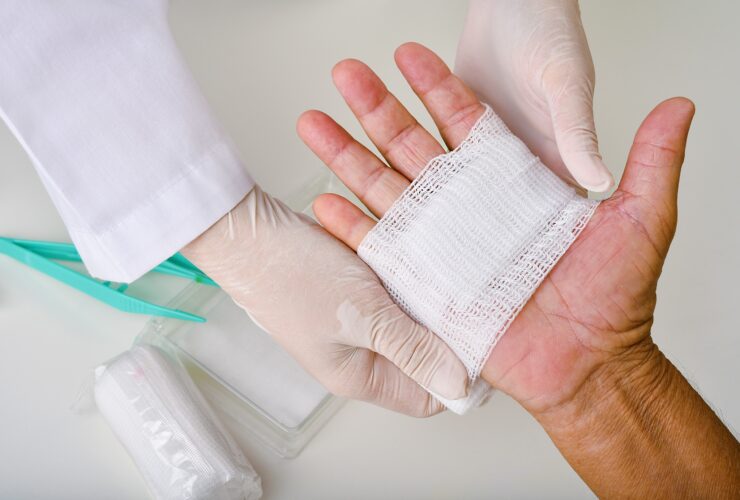 زخم های مزمن؛ یک اپیدمی خاموش