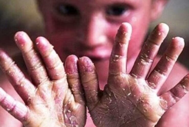 کلیه متقاضیان می توانند در فراخوان واردات پانسمان بیماران در