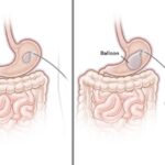 اختراع جدیدی که از چاقی جلوگیری می کند