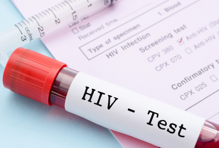 این افراد مبتلا به HIV می توانند ازدواج کنند