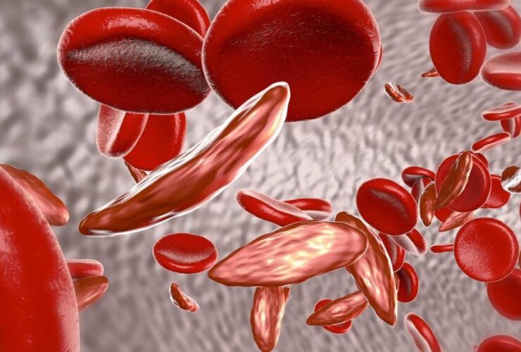 در اینجا اکسیر زندگی حیاتی تر می شود