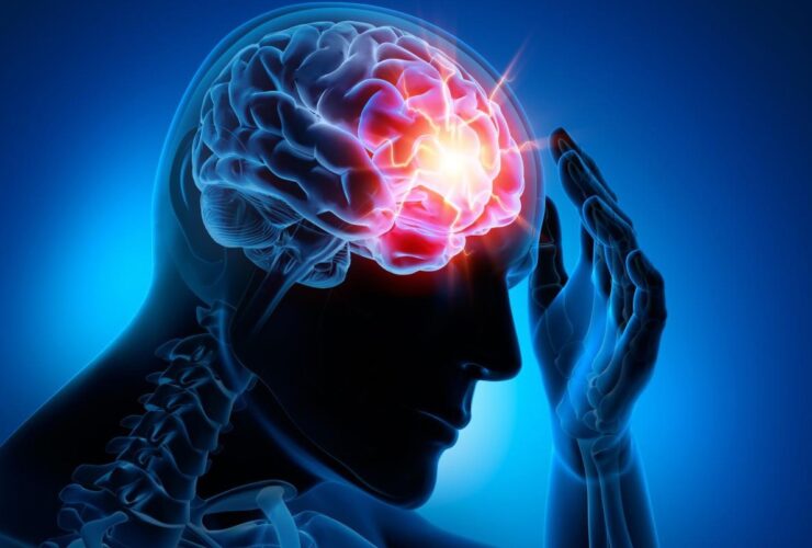 علائم هشدار دهنده تومور مغز
