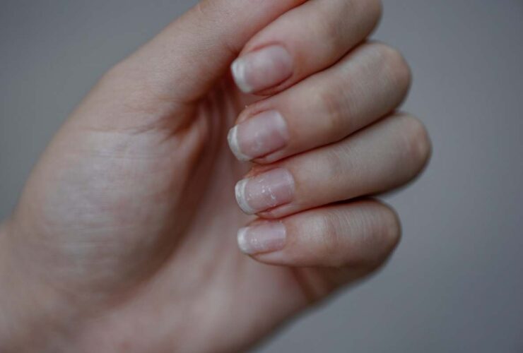 سرعت رشد ناخن با روند پیری بدن همراه است