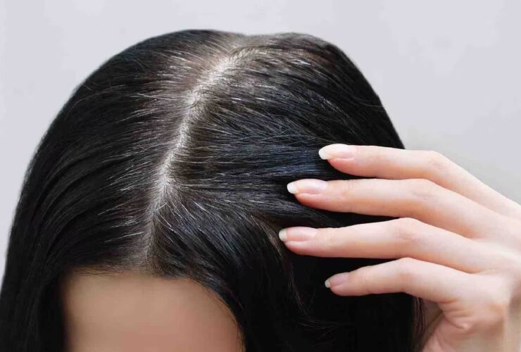 چگونه می توان به موهای خود بین 1 تا 5
