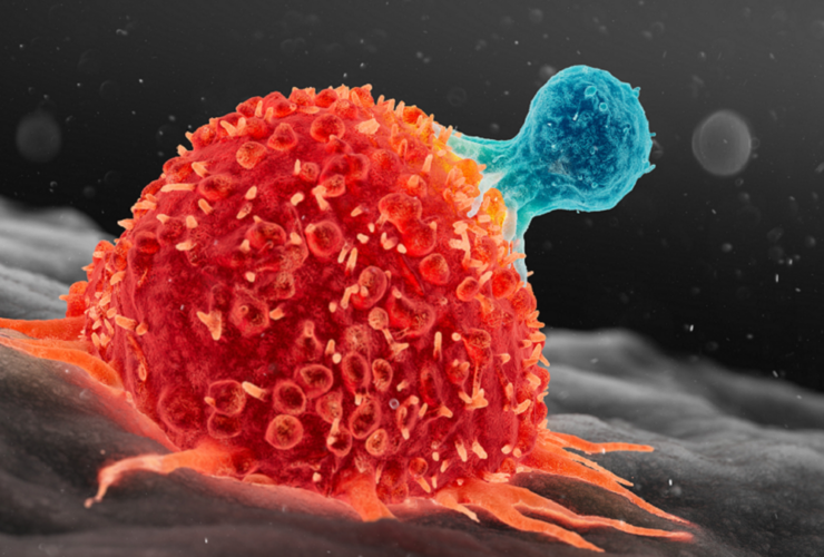 افزایش آمار سرطان در ایران برای بیست سال آینده 33 bato-adv