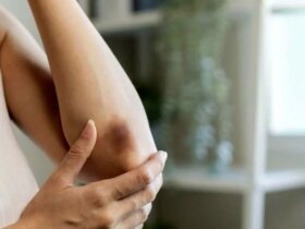 اختلال نادر در پشت کبودی های شما پنهان شده است