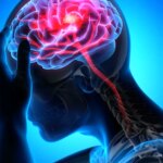 خستگی دائمی ؛ سیگنال سکته مغزی کمتر شناخته شده