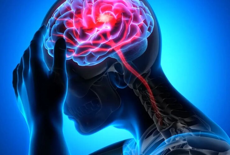 خستگی دائمی ؛ سیگنال سکته مغزی کمتر شناخته شده