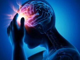 علائمی که می گویند سکته مغزی است