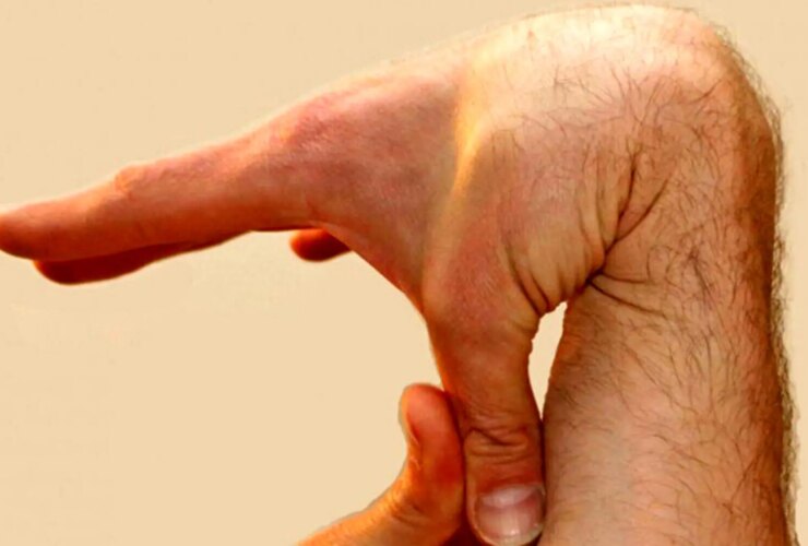 نرمی بیش از حد انگشتان ؛ علائم یک بیماری جدی!