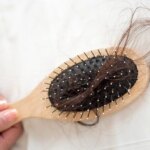 چه تعداد سوء تفاهم در مورد ریزش مو