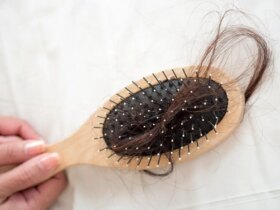 چه تعداد سوء تفاهم در مورد ریزش مو