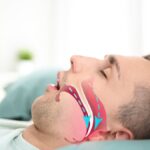 آپنه خواب ؛ یک تهدید ساکت برای نفس کشیدن