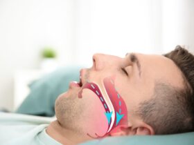 آپنه خواب ؛ یک تهدید ساکت برای نفس کشیدن