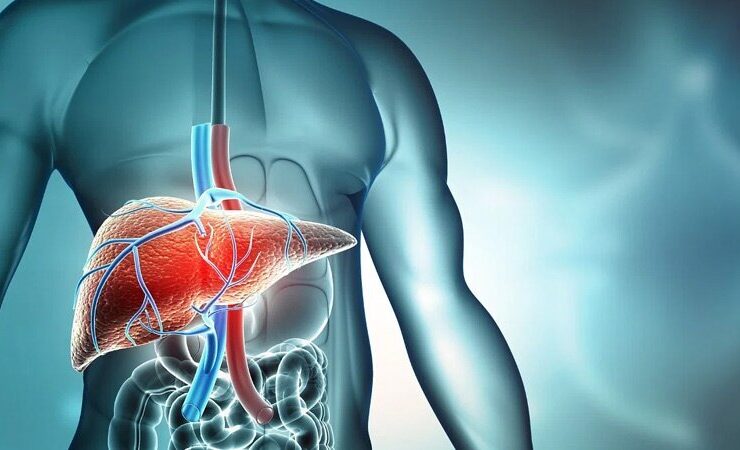 تمیز کردن کبد با راه حل های طب سنتی