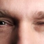 کنه های عصبی ؛ از تعریف گرفته تا دلیل بروز و عوامل عامل