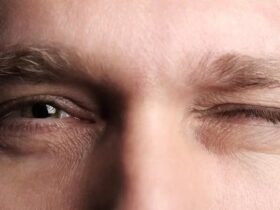 کنه های عصبی ؛ از تعریف گرفته تا دلیل بروز و عوامل عامل