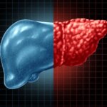 آیا علائمی از این بیماری ساکت دارید؟