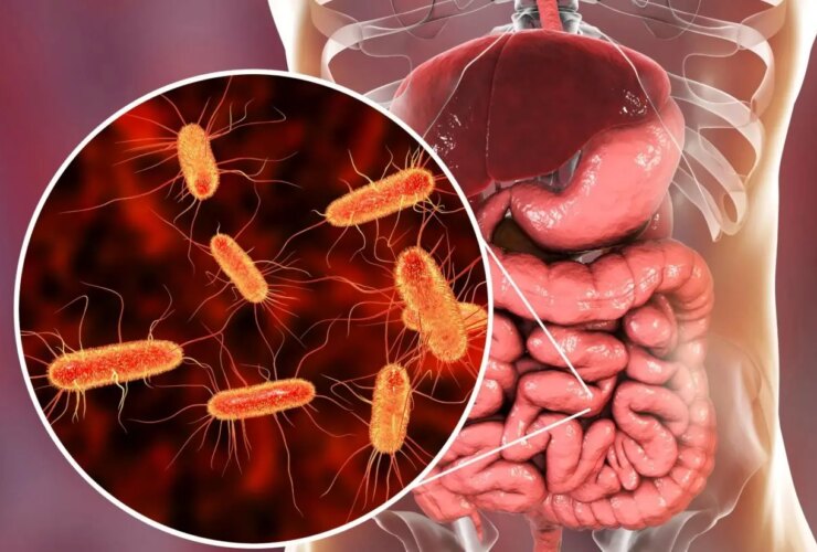 هفت عادت مخرب برای سلامت روده