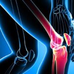 عادات روزانه که سلامت استخوان را به خطر می اندازد