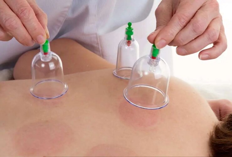 مزایای گودال در ماه های تابستان