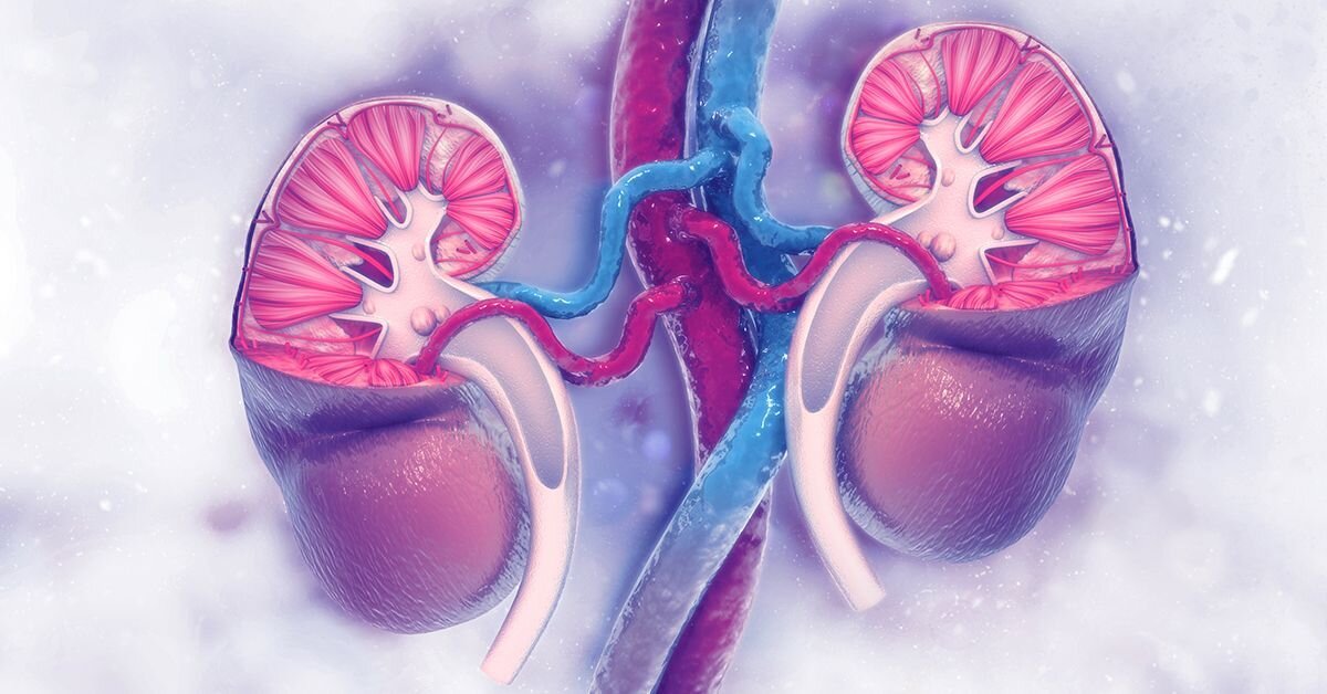 هیدرونفروز ؛ از عوامل و علائم بیماری گرفته تا راهکارهای پیشگیری مؤثر