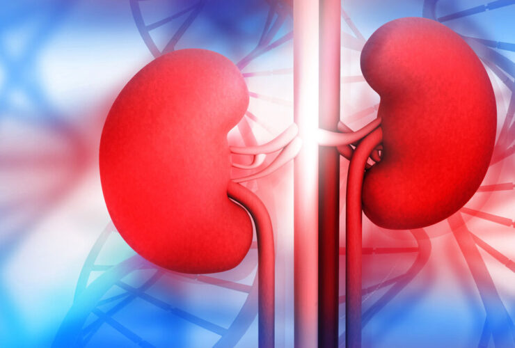 هیدرونفروز ؛ از عوامل و علائم بیماری گرفته تا راهکارهای پیشگیری مؤثر