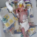 یک معجزه کوچک در بخش NICU بیمارستان شریعت در ایسفاهان