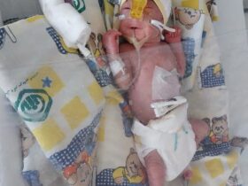 یک معجزه کوچک در بخش NICU بیمارستان شریعت در ایسفاهان