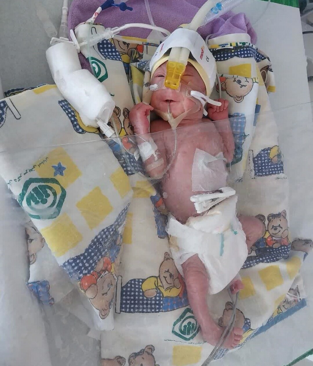 یک معجزه کوچک در بخش NICU بیمارستان شریعت در ایسفاهان