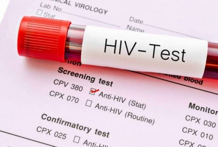 داروی جدید پیشگیری از HIV تأیید FDA را دریافت کرد