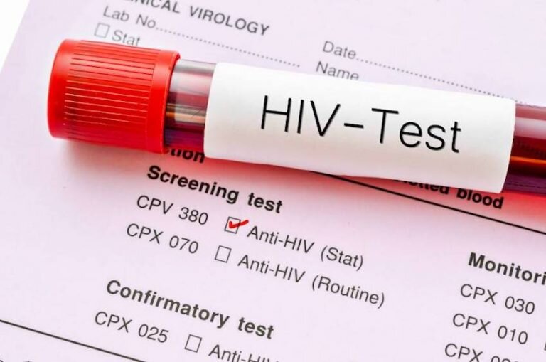 داروی جدید پیشگیری از HIV تأیید FDA را دریافت کرد