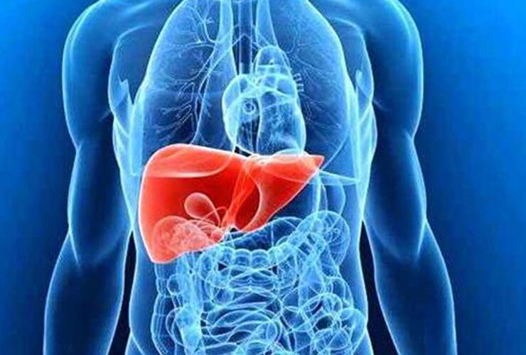 آیا مصرف بیش از حد آب منجر به کبد چربی می شود