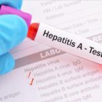 5 ٪ از بیماران HIV تماشا می کردند