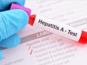 5 ٪ از بیماران HIV تماشا می کردند