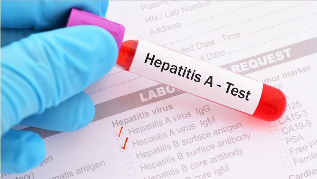 5 ٪ از بیماران HIV تماشا می کردند