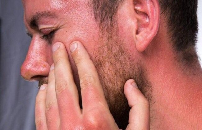 Sunburn Arbaeen ، یکی از مشکلات معمول پیاده روی